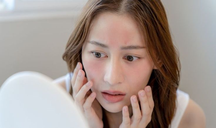 phục hồi da sau kỳ nghỉ lễ
